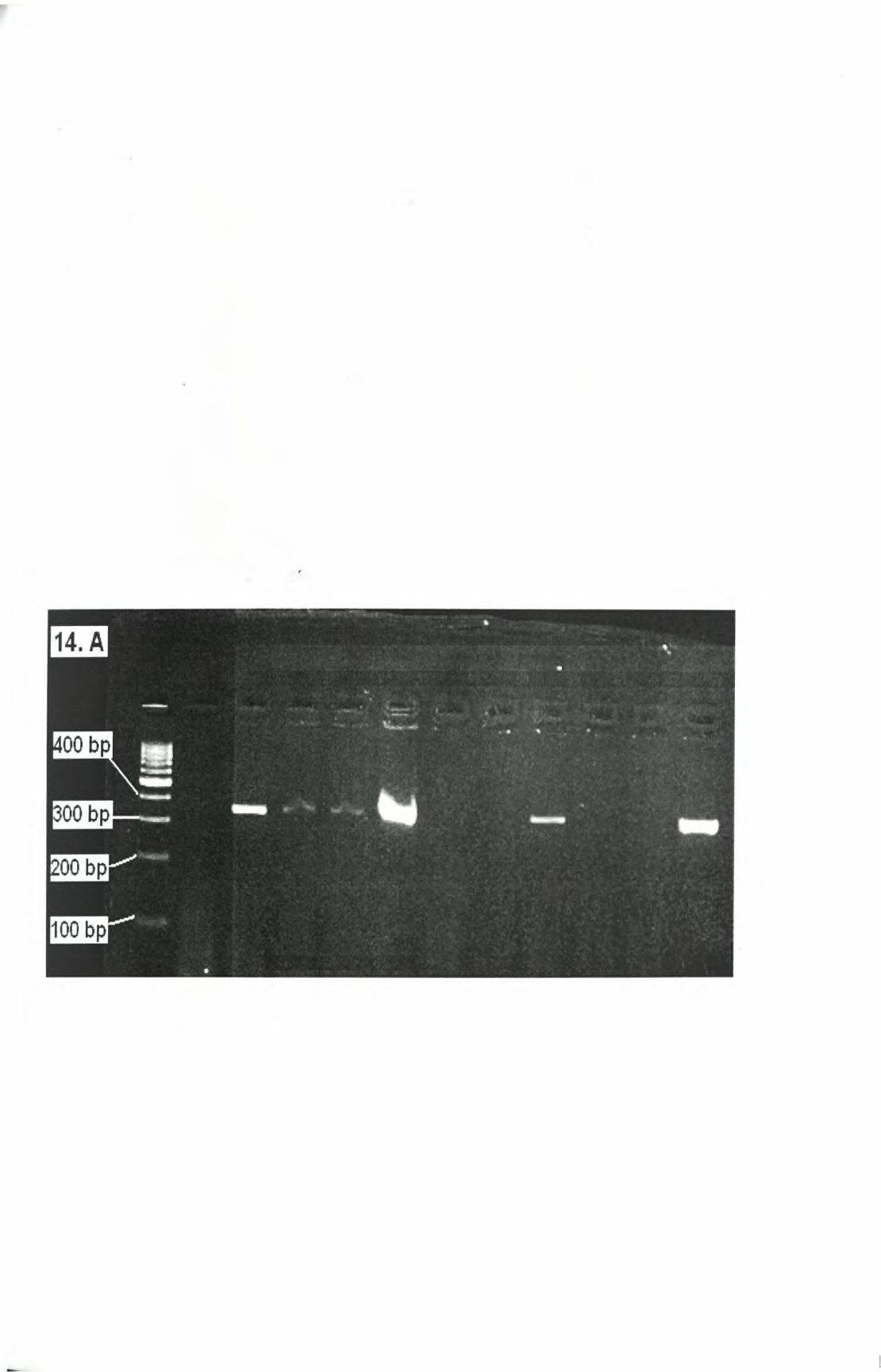 Αλυσιδωτή αντίδραση πολυμεράσης (PCR): Η PCR.