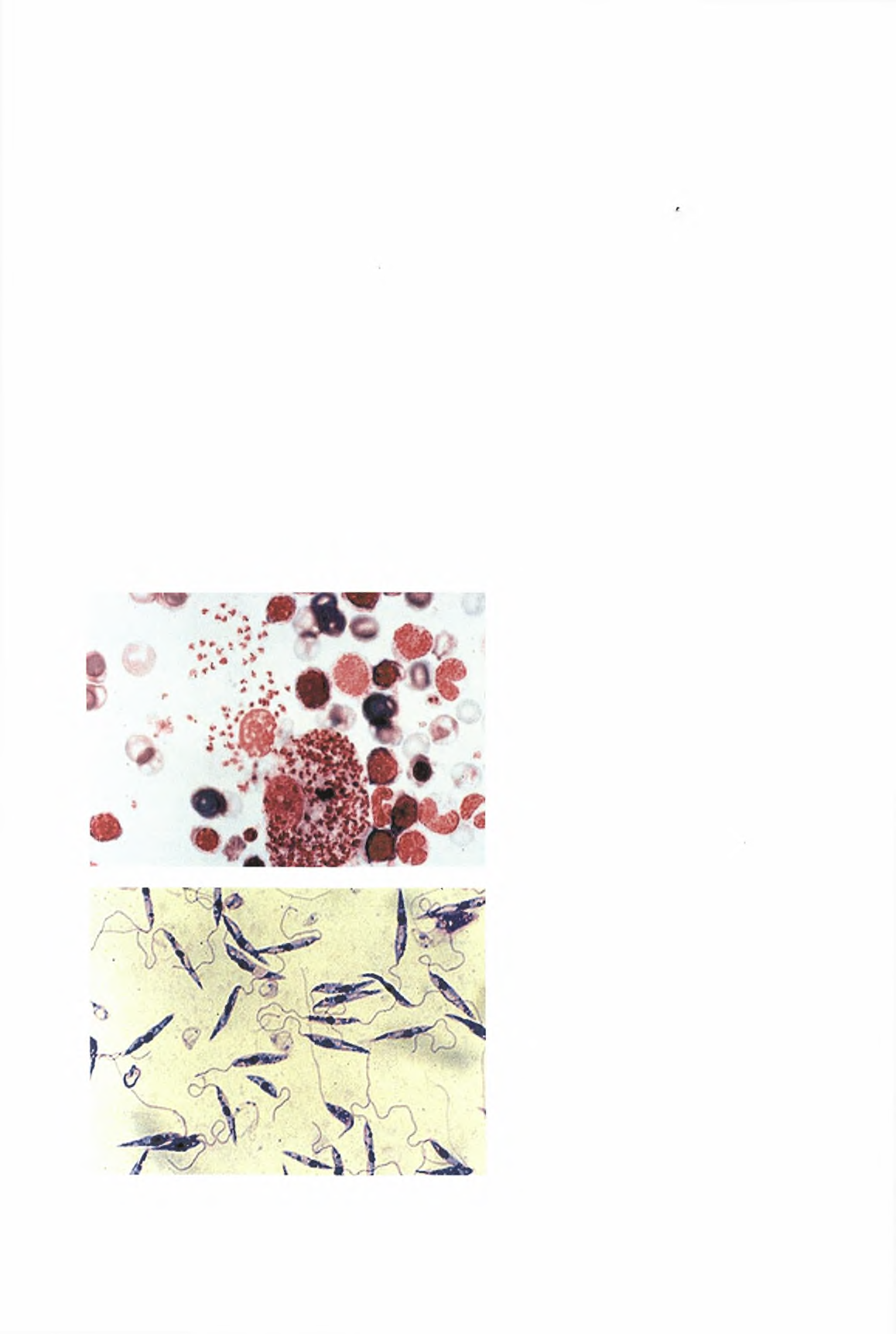 Το παράσιτο Leishmania: H Leishmania είναι ένα πρωτόζωο που ανήκει στην τάξη Kinetoplastida και την οικογένεια Trypanosomatidae.