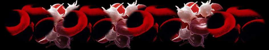 Άλφα 2B - αδρενεργικοί υποδοχείς στα αιμοπετάλια ασθενών με