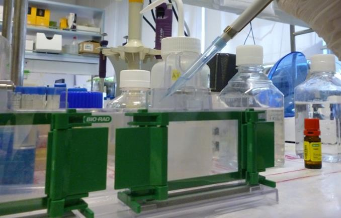 Εικόνα 2.2 Φόρτωση δείγματος στην πηκτή με μικροπιπέτα τύπου Gilson. Παρατηρήσεις 1.