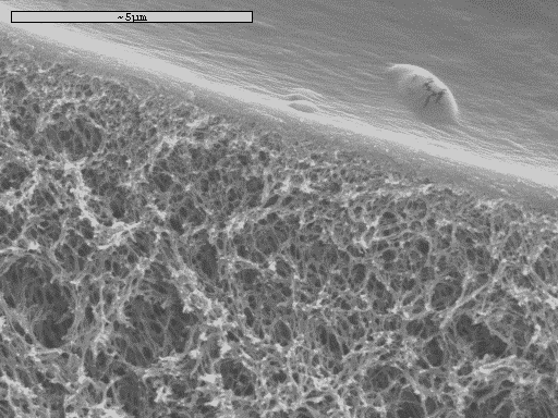 Μελέτη ρύπανσης μεμβρανών υπερδιήθησης c) d) Σχήμα 6 12: Εικόνες από ηλεκτρονικό μικροσκόπιο σάρωσης (SEM) των επικαθήσεων που δημιουργήθηκαν στη μεμβράνη υπερδιήθησης κατά τη διήθηση 10 mg/l