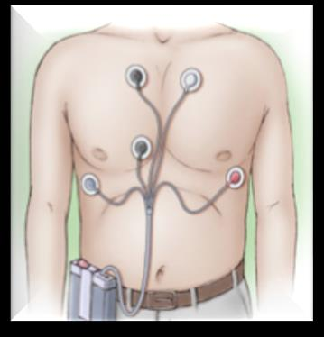 Ανίχνευση και καταγραφή αρρυθμίας -Hour Holter Event Recorder 14-3 Day MCT *