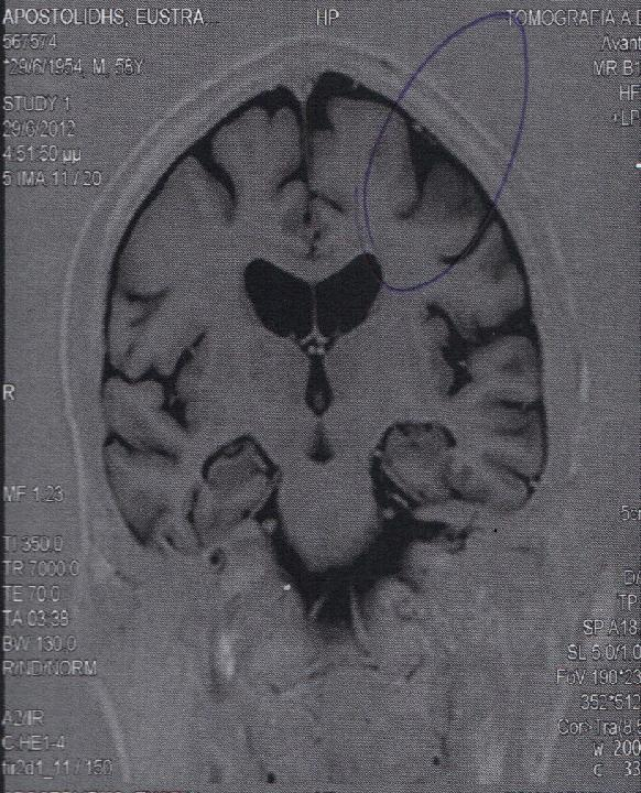 MRI- 2012