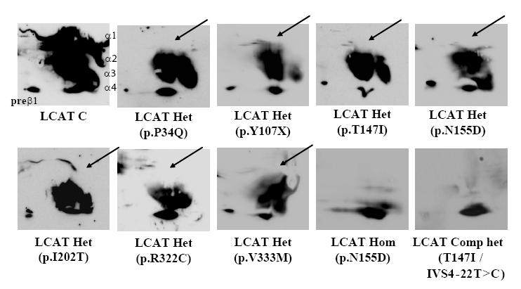 SAA/HDL-c (RLU) SAA/HDL-c Συγκέντρωση PAF (μg/dl) PAF concentration (μg/dl) Α. 4 Β.