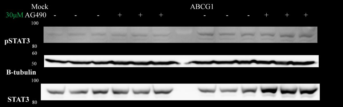 Α. Mock ABCG1 AG490 - - - + + + - - - + + + pstat3 Β-τουμπουλίνη STAT3 100kDa 80 60 50 100 80 Β. 0.06 Ένταση μπάντας pstat3/ Ένταση μπάντας STAT3 0.034 179% 0.03 0.019 100% 0.017 89% * 0.022 116% 0.