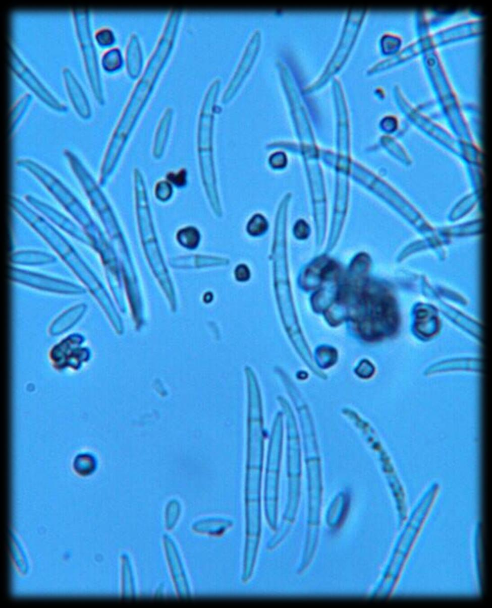 συνθήκες ανάπτυξης Fusarium oxysporum σχηματίσει