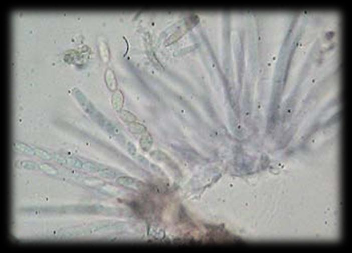 τάξη: Tuberculariales