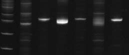 A B C D E F G A : Δείκτης μοριακού βάρους (50bp) B : Προϊόν PCR αντίδρασης για τη μελέτη του ανασυνδυασμού των γονιδιακών τμημάτων της βαριάς αλυσίδας της ανοσοσφαιρίνης (IgH) (θετικό) C : Μάρτυρας