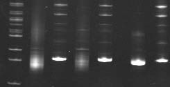 A B C D E F G A : Δείκτης μοριακού βάρους (50bp) B : Προϊόν PCR αντίδρασης για τη μελέτη του ανασυνδυασμού των γονιδιακών τμημάτων της βαριάς αλυσίδας της ανοσοσφαιρίνης (IgH) (αρνητικό) C : Μάρτυρας