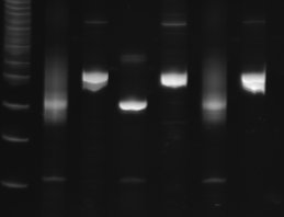 A B C D E F G A : Δείκτης μοριακού βάρους (50bp) B : Προϊόν PCR αντίδρασης για τη μελέτη του ανασυνδυασμού των γονιδιακών τμημάτων της γ αλυσίδας του TCR (αρνητικό) C : Μάρτυρας ελέγχου ποιότητας DNA