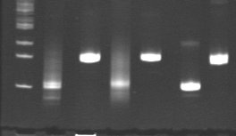 A B C D E F G A : Δείκτης μοριακού βάρους (50bp) B : Προϊόν PCR αντίδρασης για τη μελέτη του ανασυνδυασμού των γονιδιακών τμημάτων της γ αλυσίδας του TCR (θετικό) C : Μάρτυρας ελέγχου ποιότητας DNA