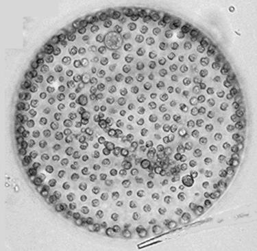 14 Άθροισμα (Φύλο - Division) Chlorophyta Ή Κλάση Chlorophyceae (Χλωροφύκη) - συνέχεια Γένος Volvox (Τάξη Volvocales) Σχηματίζει