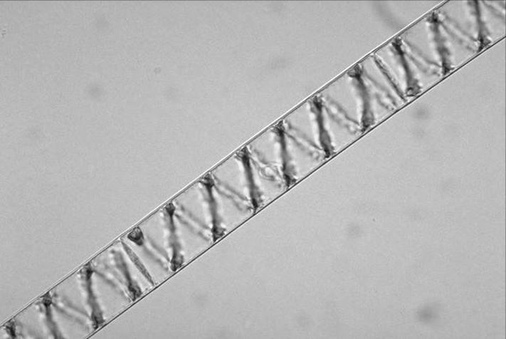 5 β. Οικογένεια Zygnemaceae Νηματοειδείς, μη διακλαδισμένες, ελεύθερες