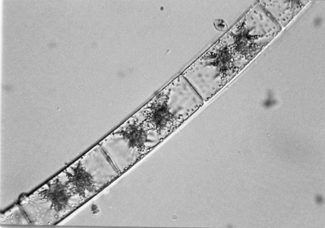 Χαρακτηριστικά γένη: Spirogyra, Zygnema. Γένος Spirogyra Εικ. 9.