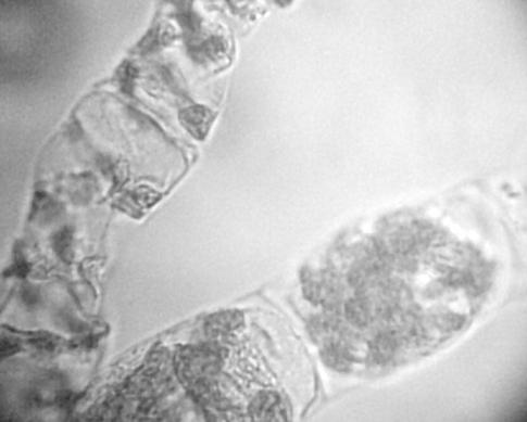 Γένος Spirogyra, εικόνες από μόνιμο