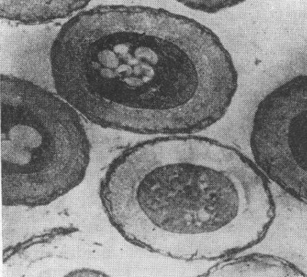 Obr. 42. Cysty baktérie Azotobacter sp. Ultratenký rez, snímky SEM, zv. 23 000x (Wyss, in: Betina a Nemec, 1977). 5. 4. Odpoveď nesporulujúcich baktérií na zmeny prostredia Na prežitie nesporulujúcich bakteriálnych buniek v stresových podmienkach je rozhodujúca ich adaptácia na zmenené podmienky prostredia.