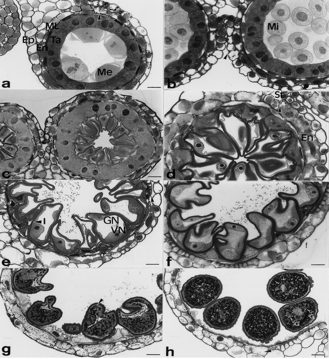Εικόνα 1.7. Εγκάρσιες τομές ανθήρων σιταριού σε διάφορα στάδια ανάπτυξης, a) στάδιο μείωσης: το βέλος δείχνει τους αμυλόκοκκους στα επιδερμικά (Ep) και ενδοθηλιακά (En) κύτταρα.