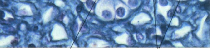 επιθηλιακών κυβοειδών Μορφολογία: Κύτταρα