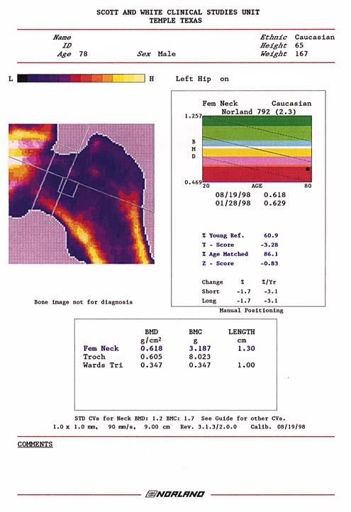 DEXA