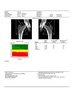 DEXA