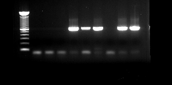 4.2 Αποτελέσματα υποτυποποίησης ιών γρίπης Α με RT-PCR (reverse transcription-pcr) Σε όλα τα 119 στελέχη ιών γρίπης Α που ανιχνεύθηκαν έγινε μοριακή υποτυποποίηση με τη μέθοδο RT-PCR.