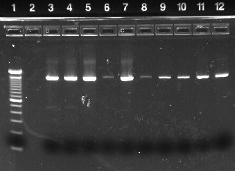 1407 ο του γονιδίου της ΝΑ. Τα αποτελέσματα της ηλεκτροφόρησης των προϊόντων της PCR φαίνονται στην Εικόνα 15. 1406bp Εικόνα 15.