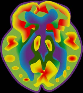 DEMENŢA ALZHEIMER EXPLORARE