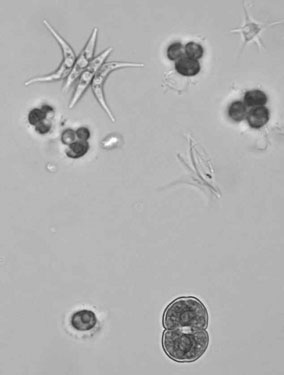 več nadomestnih celic v polienergidno celico, ki se razraste v gonimoblast izomorfni haplodiplonti rast z apikalnimi celicami, tudi interkalarna, naknadno se razvijejo
