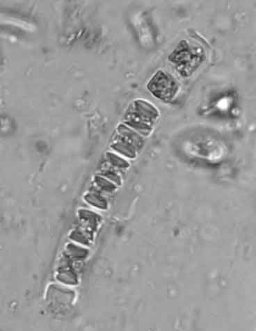 Alge: Chlorophyta 2 razmnoževanje: različni tipi spolnega, nespolnega in vegetativnega