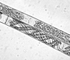 Microspora Alge: Chlorophyta 3 vsi organizacijski nivoji razen pravega parenhimatskega