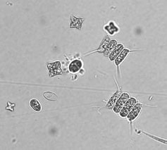 Alge: Chlorophyta: Chlorophytina vsi