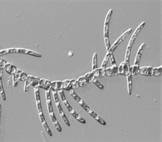 Alge: Chlorophyta: Chlorophytina cl.