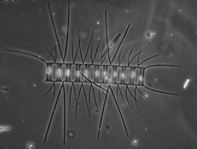 fosili Heterokontophyta: Bacillariophyceae Pennales ±dvobočno somerne 2