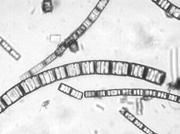 Bacillariophyceae Centrales ±radialno somerne več plastidov jedro ob