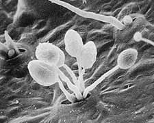 Heterokontophyta: Oomycetes stena celulozna gametangiogamija, zigota trajna, diplonti; nespolno: