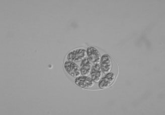 ), 500 vrst Phytophthora Alge: Glaucophyta Glaucophyta: klorofil a (d?