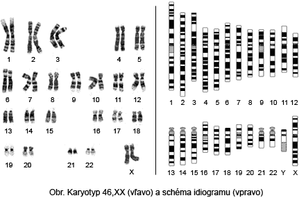 Genetické termíny Karyotyp vs.