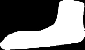 ankle Calcaneus