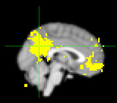 (Lateral visual) 24: Δίκτυο