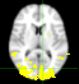 (Lateral visual) 30: