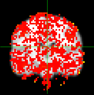 15 ότι οι βαθμοί συμμετοχής των voxels του εγκεφάλου σε καθεμία συστάδα είναι