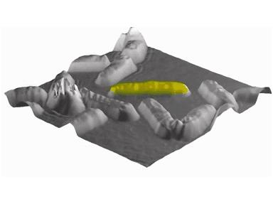 Πλεονεκτήματα Δημιουργία 3D εικόνων Δημιουργία εικόνων με καλύτερη αντίθεση Εστίαση κατά την παρατήρηση και όχι