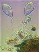 Εικόνα 14 Εικόνα 15 Τα ζωοσπόρια αποτελούνται από πρωτοπλασµατική µεµβράνη, µε σχήµα ωοειδές, 4-55ɬ6-8µ και έχουν δύο µαστίγια, 27-33µ, µε τα οποία κινούνται στο νερό.