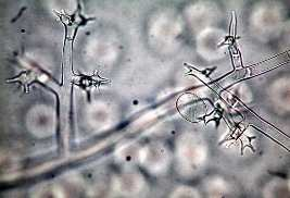 Εικόνα 19, 20: Το παθογόνο όπως φαίνεται στο µικροσκόπιο. Εικόνα 21: Οι καρποφορίες του παθογόνου όπως εξέρχονται από τον ξενιστή.