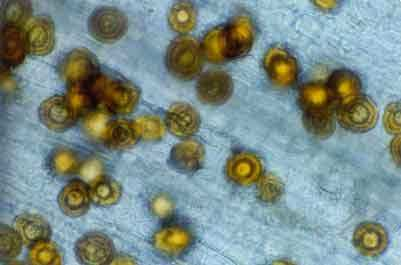 Εικόνα 77: Το παθογόνο όπως φαίνεται στο µικροσκόπιο (ωοσπόρια). Εικόνα 78: Οι σποριαγγειοφόροι του παθογόνου. 4.2.