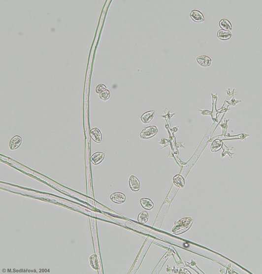 Εικόνα 2, 3: Μορφή του µύκητα στο µικροσκόπιο. Σε ολόκληρο τον κόσµο έχουν παρατηρηθεί 134 είδη για το γένος Plasmopara µε σηµαντικότερα της αµπέλου (P.