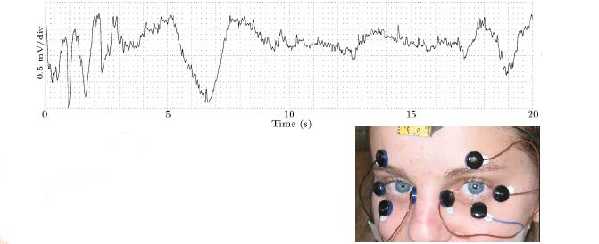 Ηλεκτροοφθαλμογράφημα (EOG) Χαρακτηριστικό