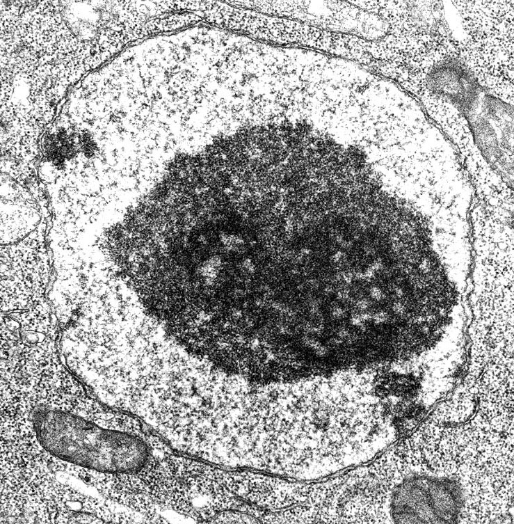 Δομή πυρήνα Arabidopsis thaliana (ΤΕΜ) 1.