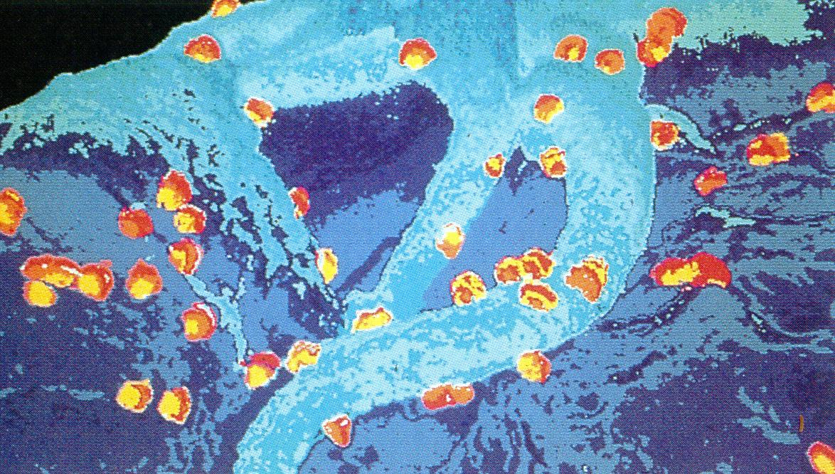Φωτογραφία του ιοφ του ζιτη (HIV) από θλεκτρονικό μικροςκόπιο.