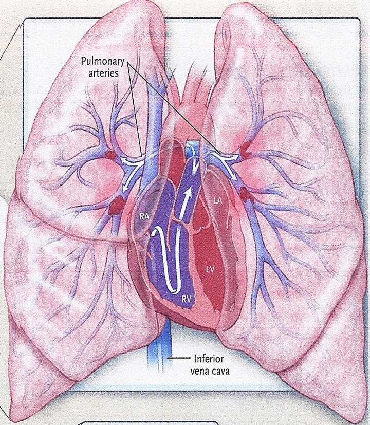 οξεία απόφραξη του πνευμονικού αρτηριακού δικτύου Χωρίς αγωγή θνητότητα 30% > 90% των θανάτων